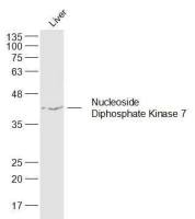 Nucleoside Diphosphate Kinase 7二磷酸核苷激酶7抗体
