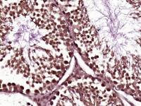 NUP155核孔复合蛋白Nup155抗体