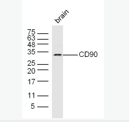 CD90抗体