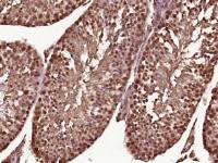 PSMA8蛋白酶体PSMα8抗体