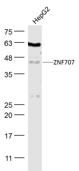 ZNF707锌指蛋白707抗体