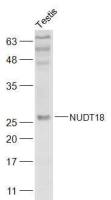 NUDT18蛋白抗体