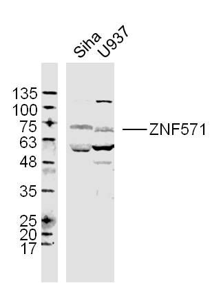 ZNF571锌指蛋白571抗体