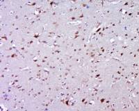 ZNF502锌指蛋白502抗体