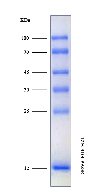蓝色预染蛋白质Marker(12-100KD)