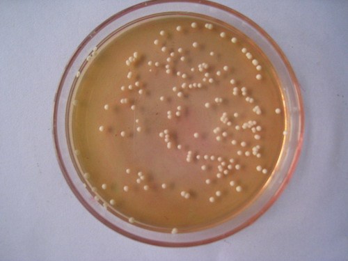 培养基制备的基本方法有哪些?