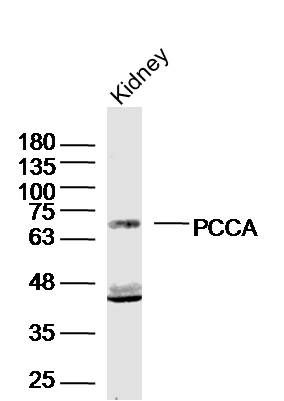 PCCA丙酰辅酶A羧化酶α链抗体