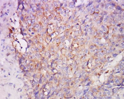DLC1肝癌缺失基因1抗体