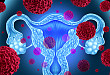 女神守护者——宫颈癌筛查与 HPV 疫苗