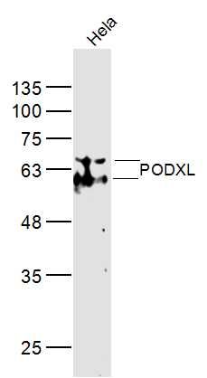 PODXL足细胞特异蛋白抗体
