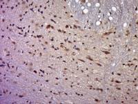 SIP1 Smad蛋白相互作用蛋白1抗体