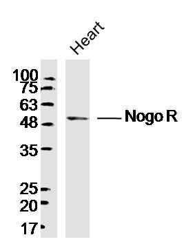 Nogo R轴索过度生长抑制因子受体/Nogo受体抗体