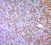 LRCH1富含亮氨酸重复家庭蛋白1抗体