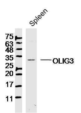 OLIG3少突胶质细胞转录因子3抗体
