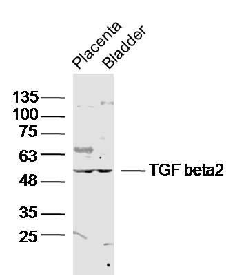TGF beta 2转化生长因子β2（TGFβ2）抗体