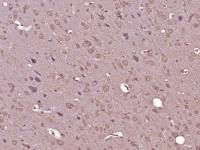 TUBA1A + TUBA1B微管蛋白α 1A/1B