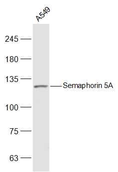 Semaphorin 5A跨膜蛋白SEMA5A抗体