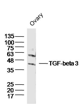 TGF-beta 3转移生长因子β3抗体（TGFβ3）
