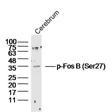 phospho-Fos B (Ser27)磷酸化癌基因FOS蛋白B抗体
