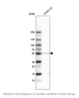 利钠肽受体A抗体