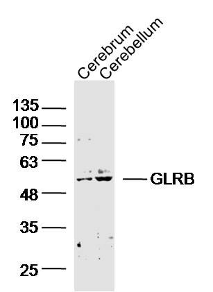 GLRB甘氨酸受体β/GlyR β抗体