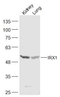 IRX1 Iroquois同源蛋白1抗体
