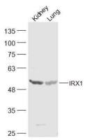 IRX1 Iroquois同源蛋白1抗体