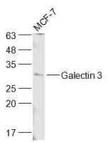 Galectin 3半乳糖凝集素3抗体
