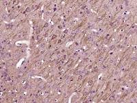 UCP-2线粒体脱偶连蛋白2抗体