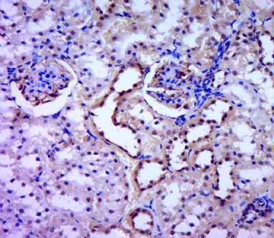DNMT-3 alpha DNA甲基转移酶-3α抗体产品图