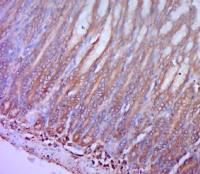 CCR-2细胞表面趋化因子受体2抗体