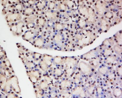 TNFAIP1肿瘤坏死因子α诱导蛋白1抗体