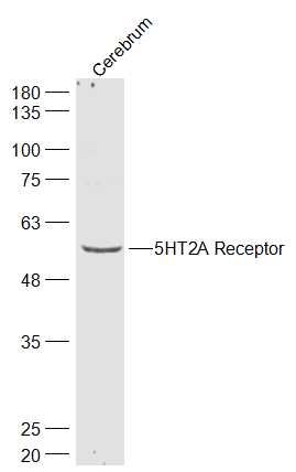 5HT2A Receptor 5-羟色胺受体2A抗体