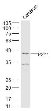 P2Y1受体抗体/嘌呤受体抗体