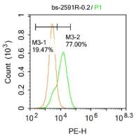 Fbx32泛素蛋白连接酶抗体