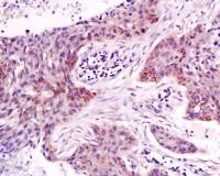 NAP2中性粒细胞活性蛋白2/血小板碱性蛋白抗体