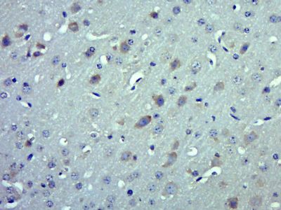 IL17A Receptor白介素17受体抗体