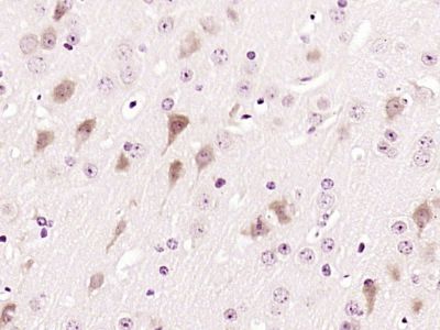CD155脊髓灰质炎病毒受体抗体