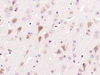 CD155脊髓灰质炎病毒受体抗体