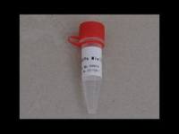 UPF1 polyclonal antibody价格