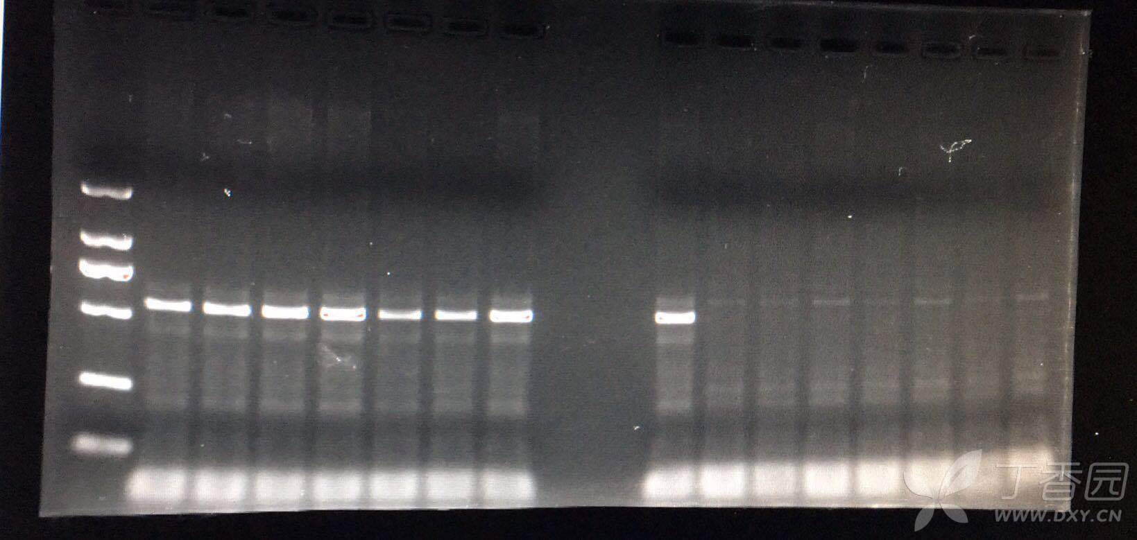 求助!关于琼脂糖凝胶电泳跑不出条带的问题 - PCR技术讨论版 -丁香园论坛