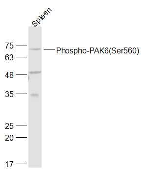 Phospho-PAK4(Ser474) + PAK5(Ser602) + PAK6(Ser560)磷酸化p21激活激酶4/5/6抗体