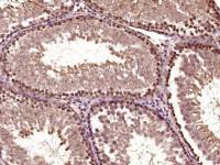 phospho-B-Raf (Ser365)磷酸化B-Raf抗体