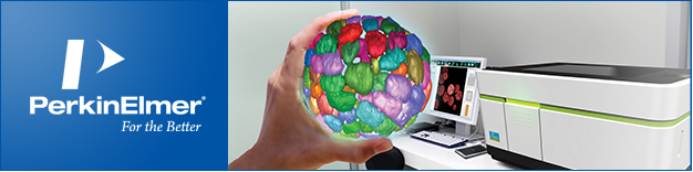 最新版 HCS 软件 Harmony® 4.8 全面解析 3D 囊肿空间信息