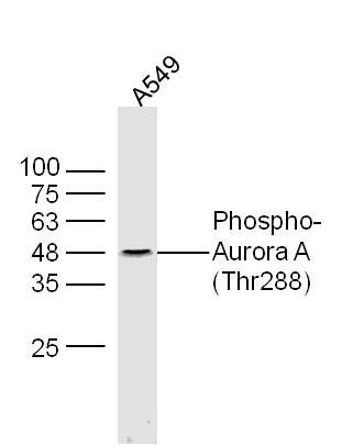 Phospho-Aurora A (Thr288)磷酸化有丝分裂激酶A抗体
