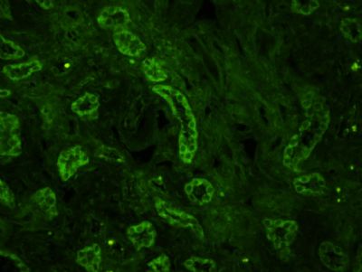 Mitofusin 2线粒体融合蛋白Mfn2抗体