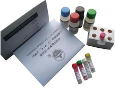 骨组织蛋白提取试剂盒(2D电泳用)