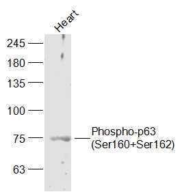 Phospho-p63 (Ser160+Ser162)磷酸化P63肿瘤抑制基因抗体