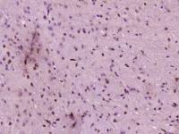 Neurogenin 2神经元素2抗体