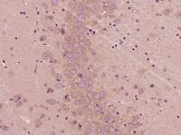 PBR外周苯二氮受体抗体